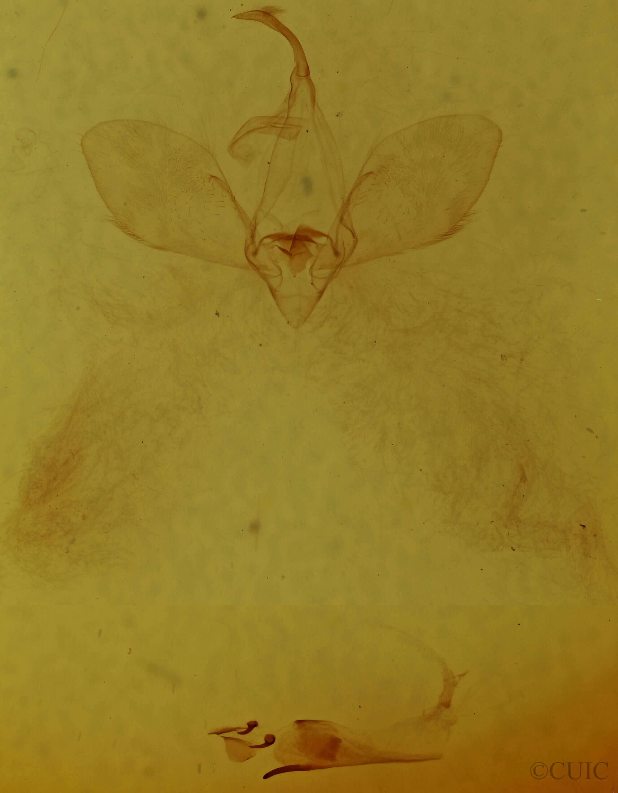 genitalia view of adult Eulepidotis sp.