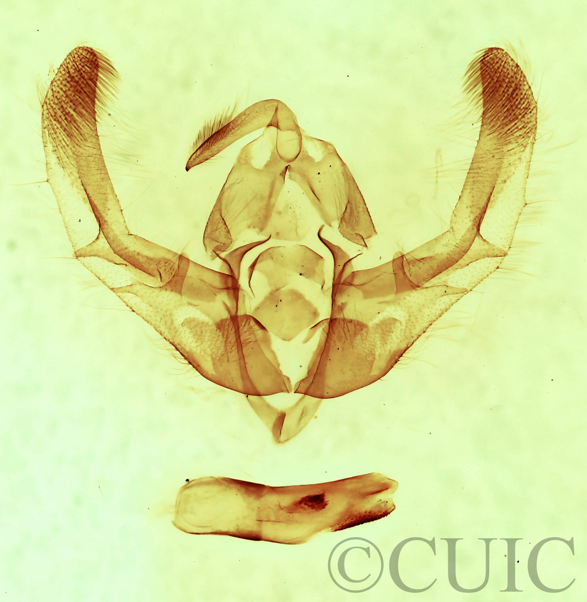 genitalia view of adult Chytonix sensilis