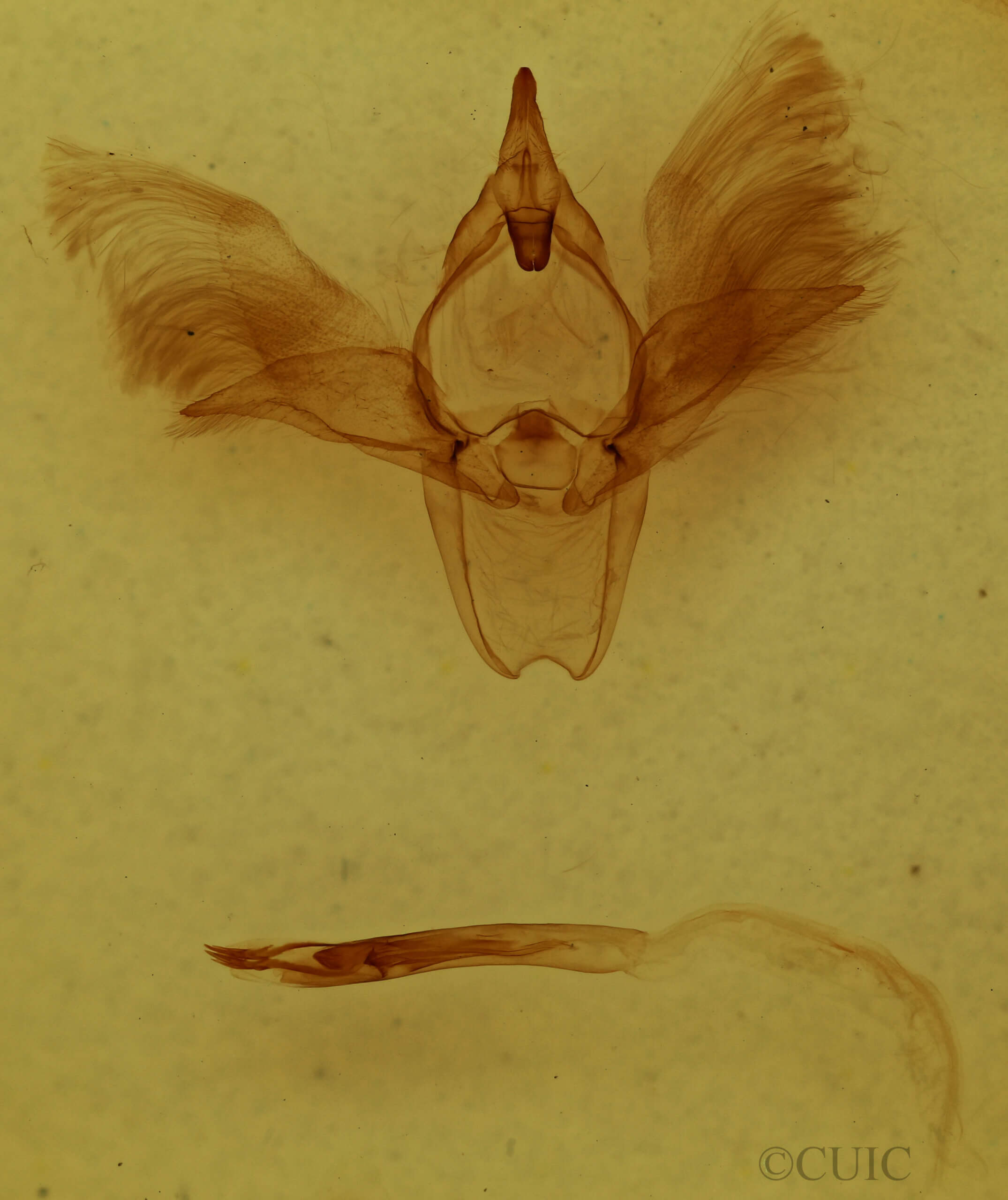 genitalia view of adult Scoedisa sp.