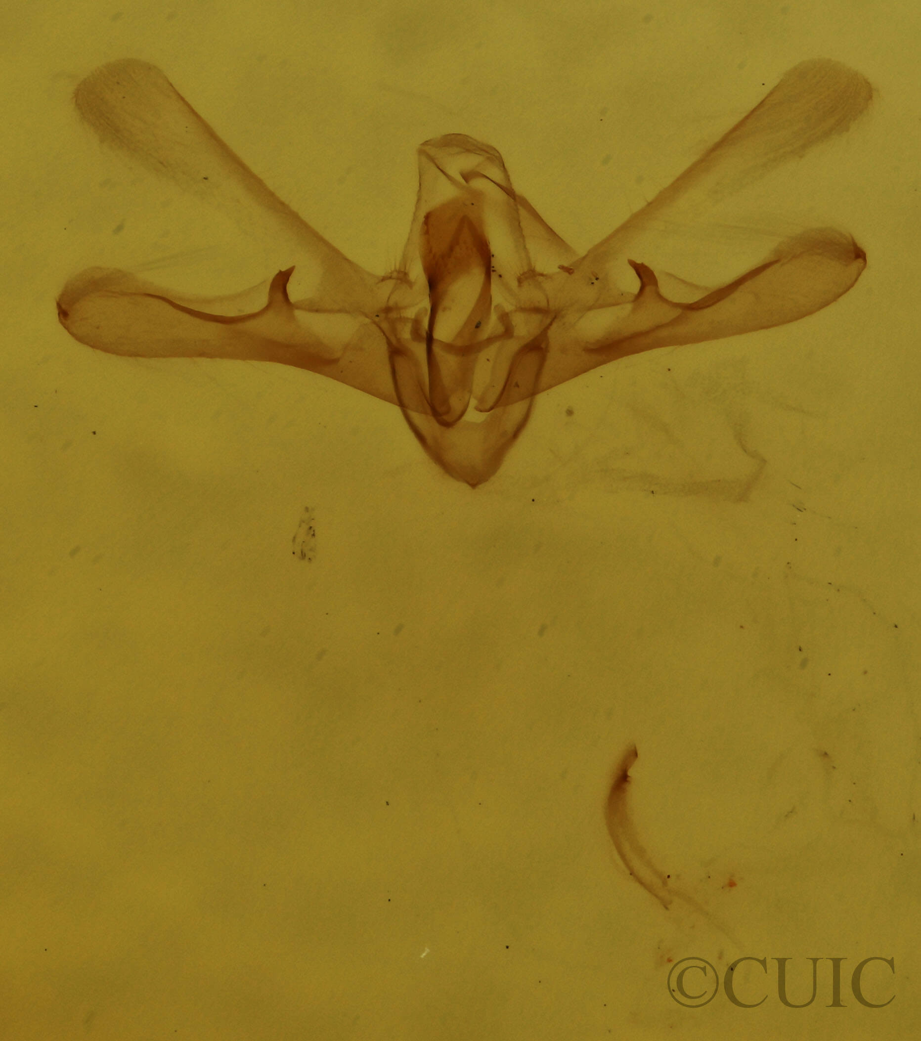 genitalia view of adult Nola sp.?
