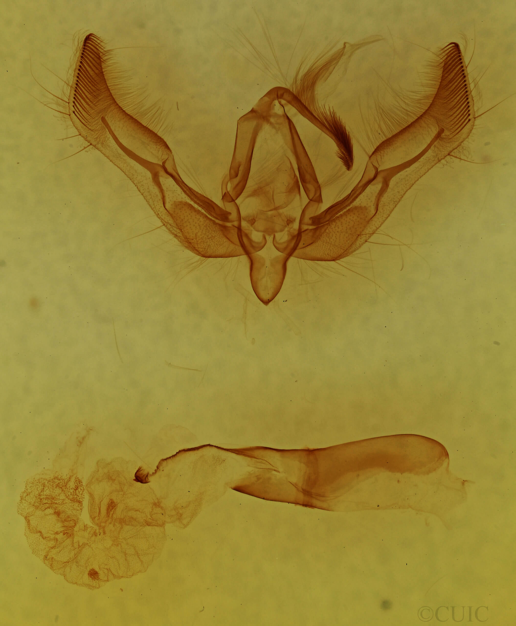 genitalia view of adult Feltia sp.