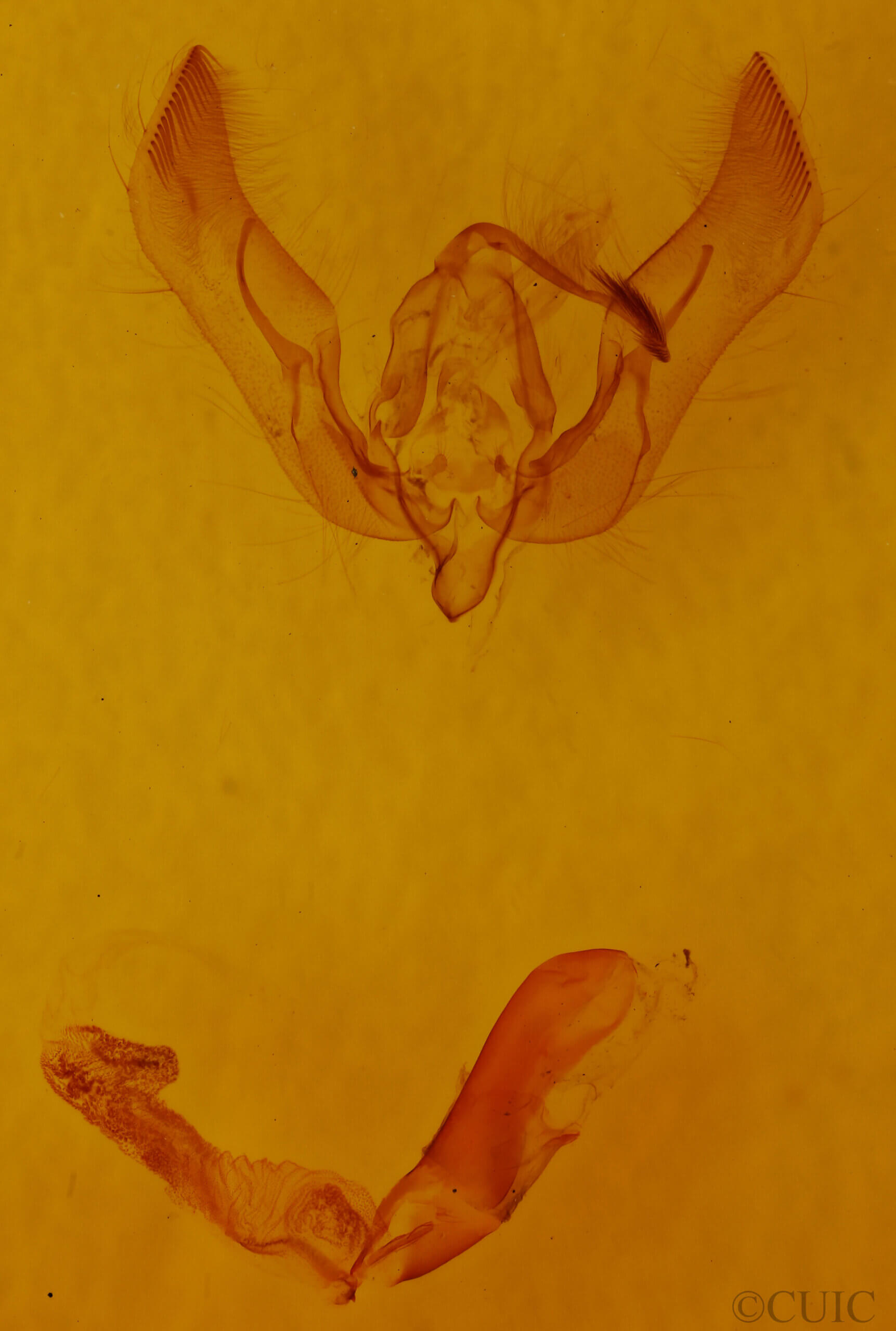genitalia view of adult Feltia sp.