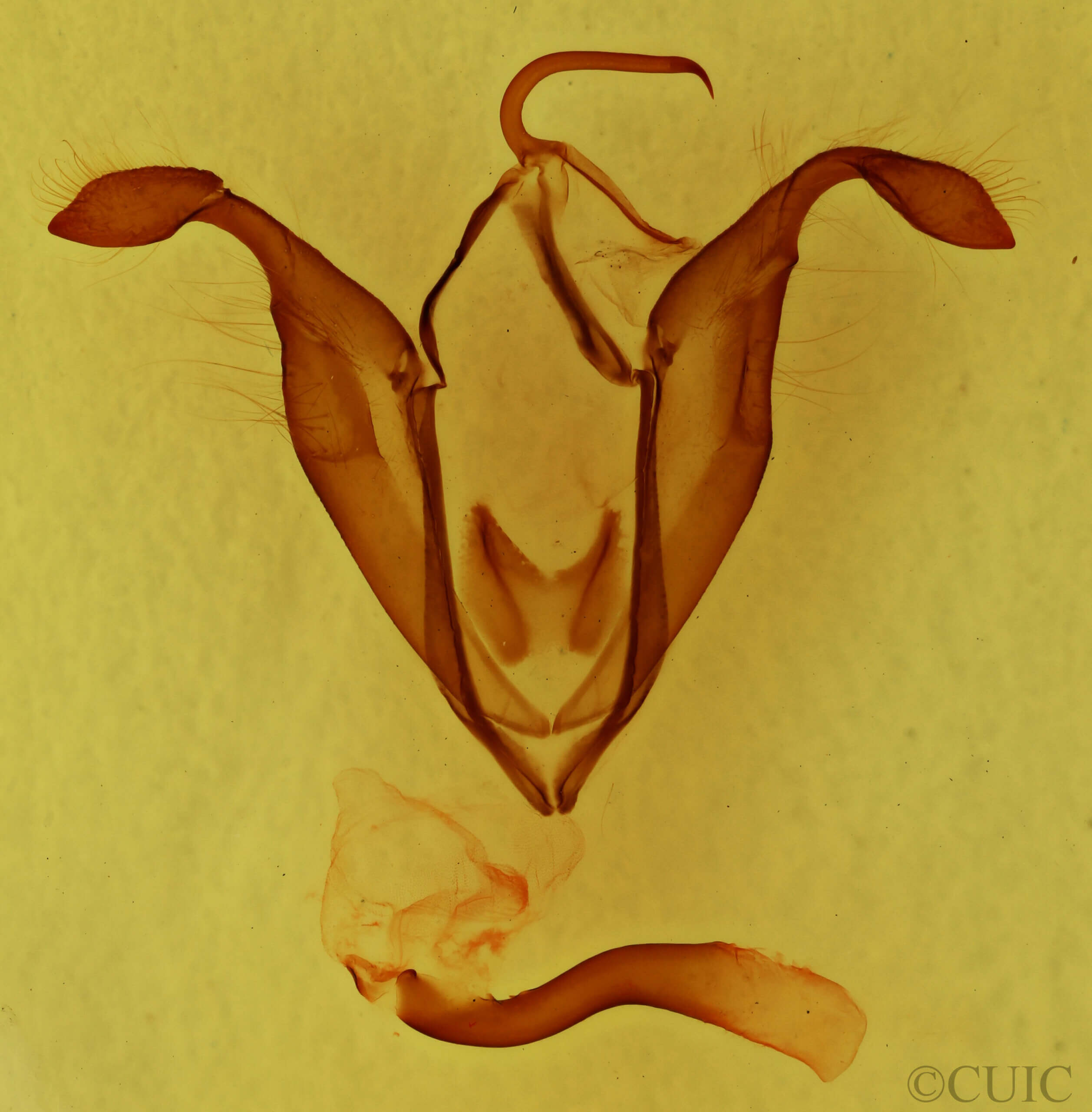genitalia view of adult Zale sp.
