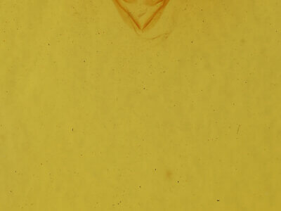 genitalia view of adult Zale n. sp. 1