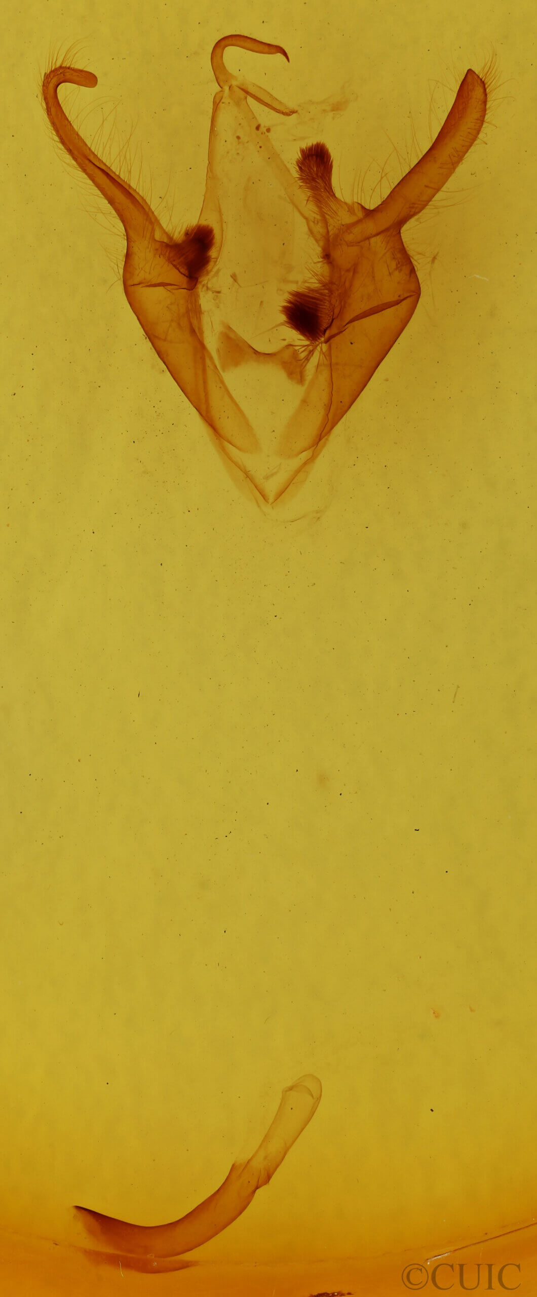 genitalia view of adult Zale n. sp. 1