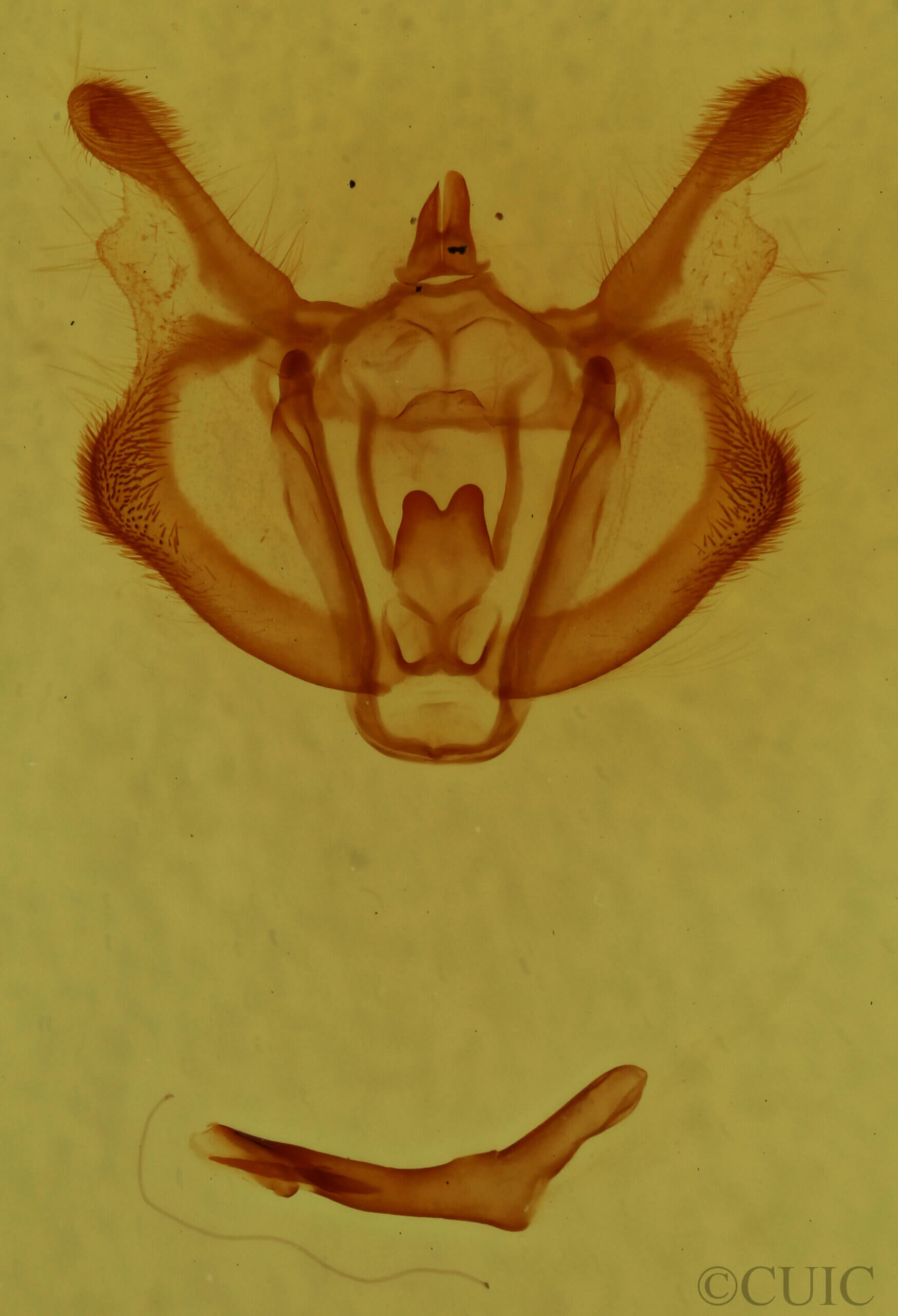 genitalia view of adult Colotois pennaria