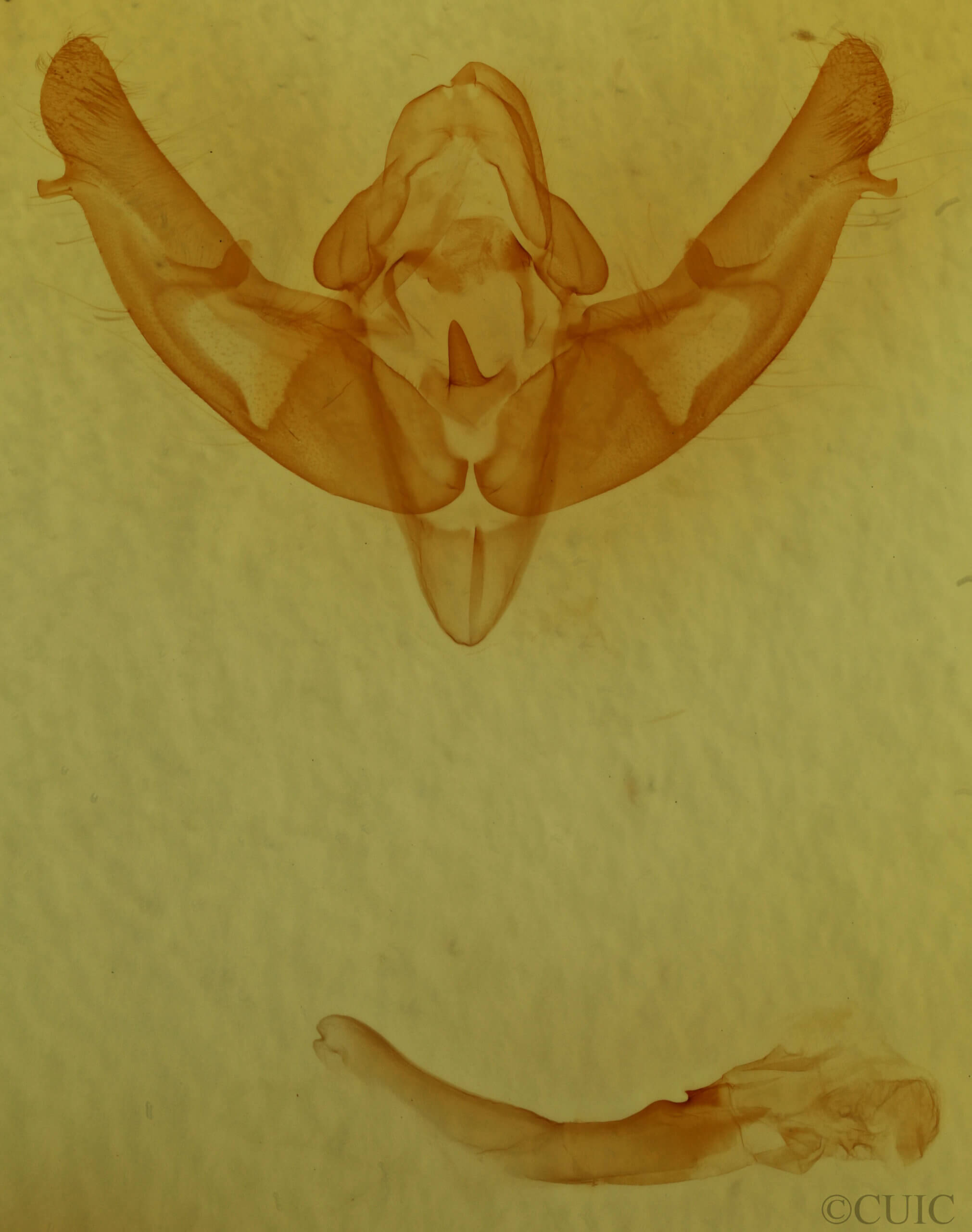 genitalia view of adult Xestia ditrapezium