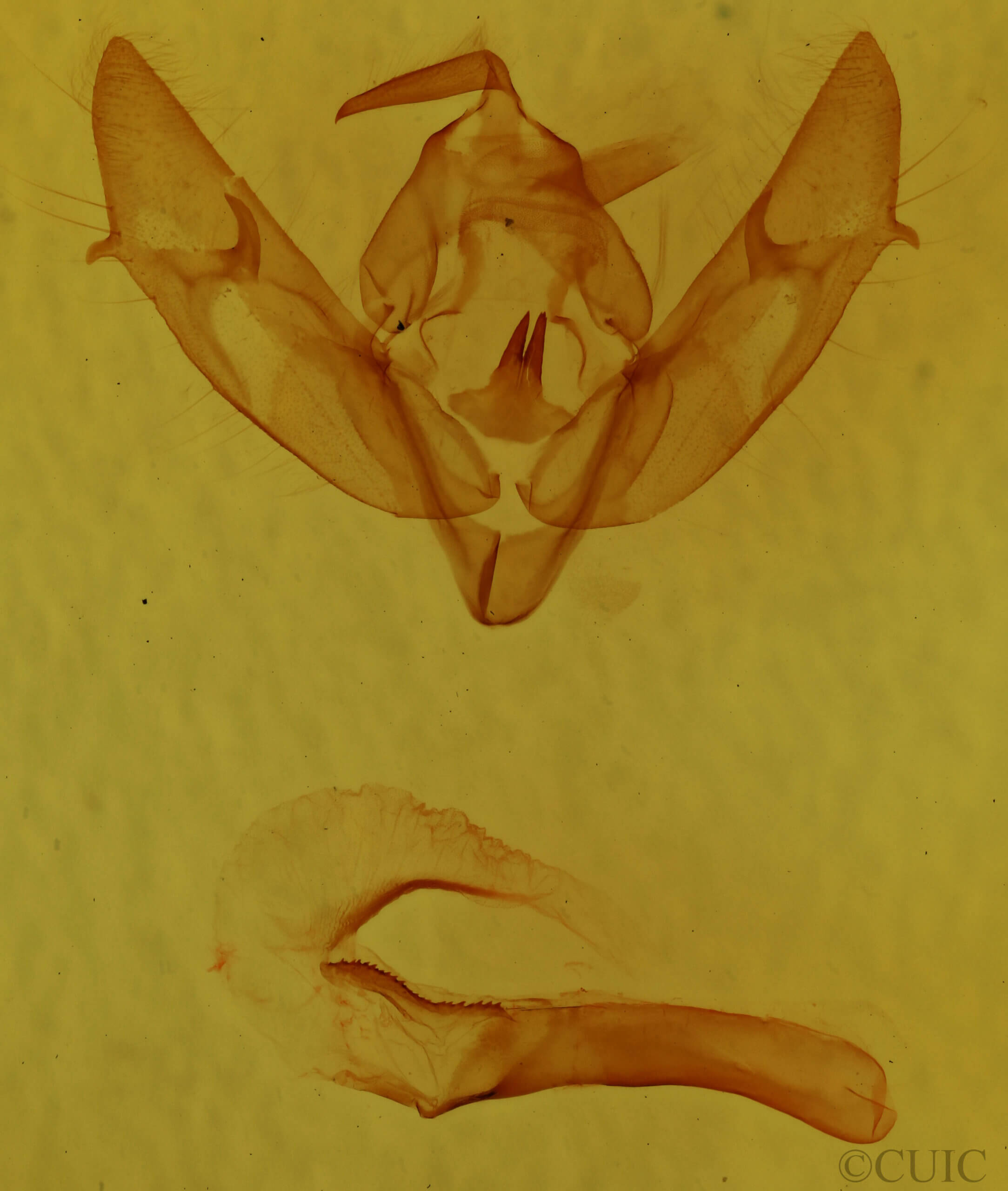 genitalia view of adult Xestia sexstrigata