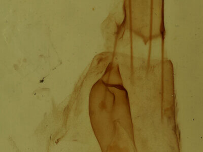 genitalia view of adult Hydriomena sp.