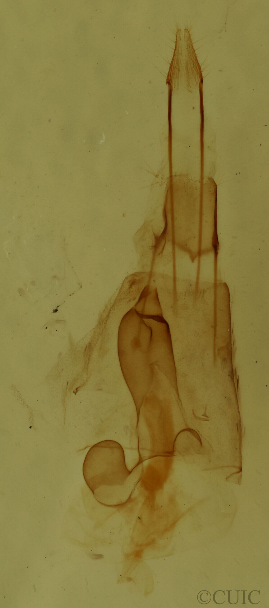 genitalia view of adult Hydriomena sp.