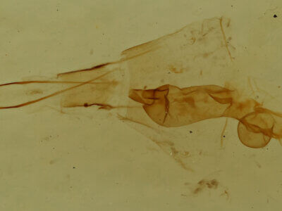 genitalia view of adult Hydriomena sp.