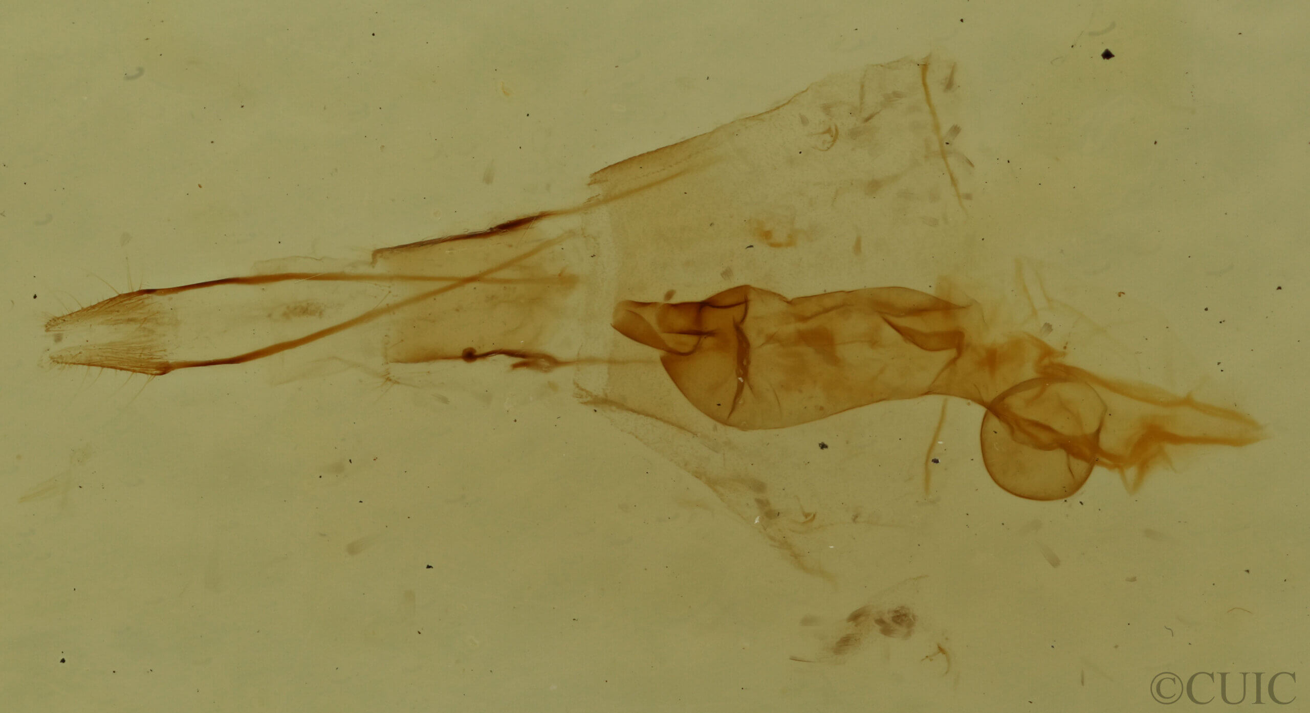 genitalia view of adult Hydriomena sp.