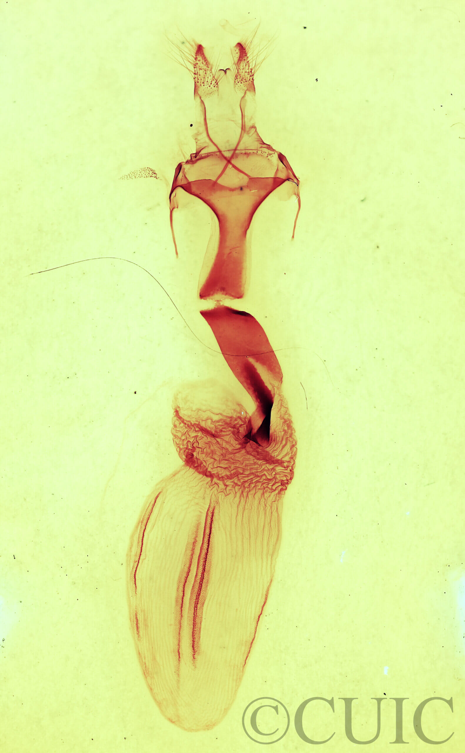 genitalia view of adult Metaxaglaea semitariaFranclemont, 1968