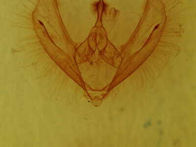genitalia view of adult Epimecis fraternaria?