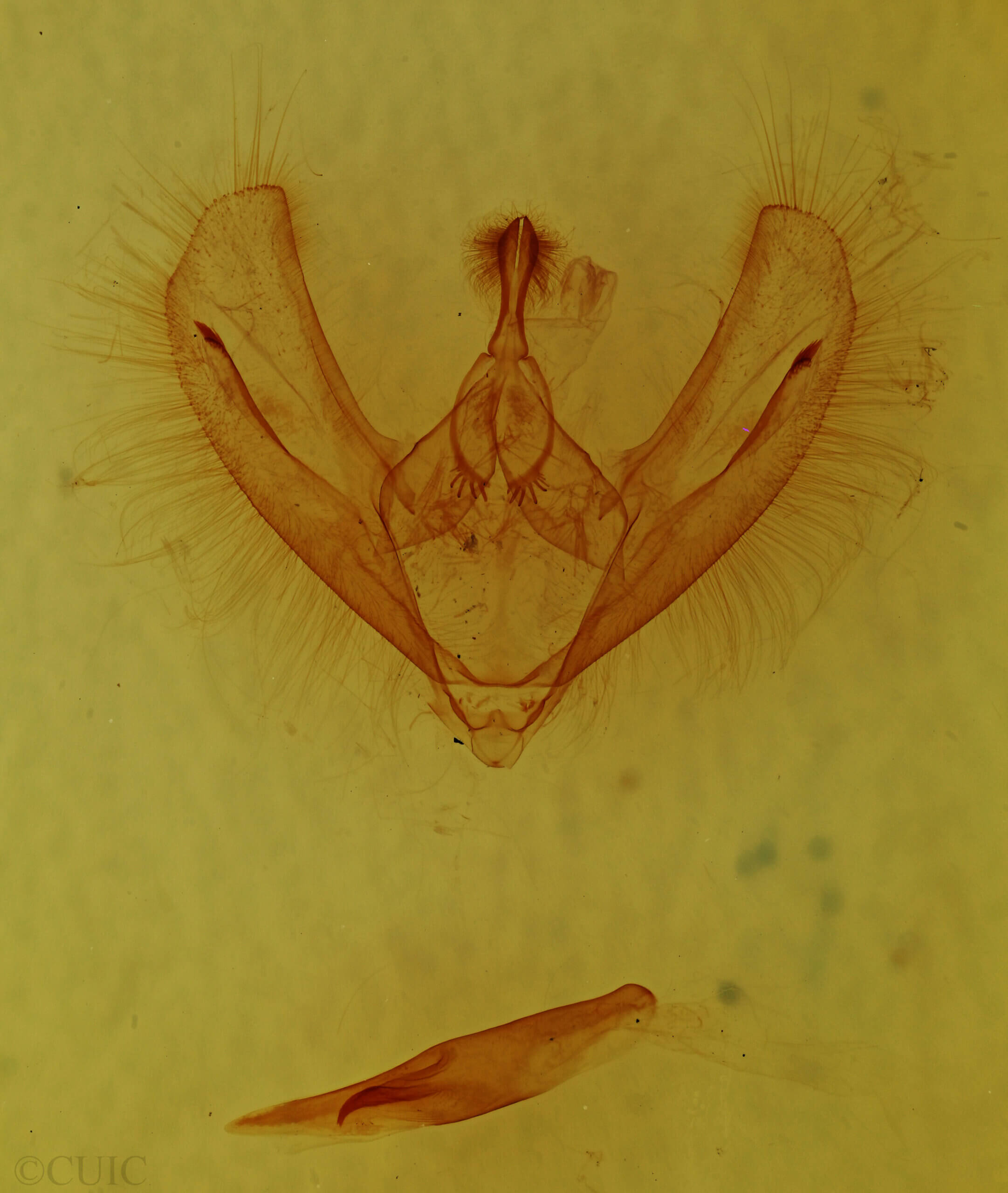 genitalia view of adult Epimecis fraternaria?