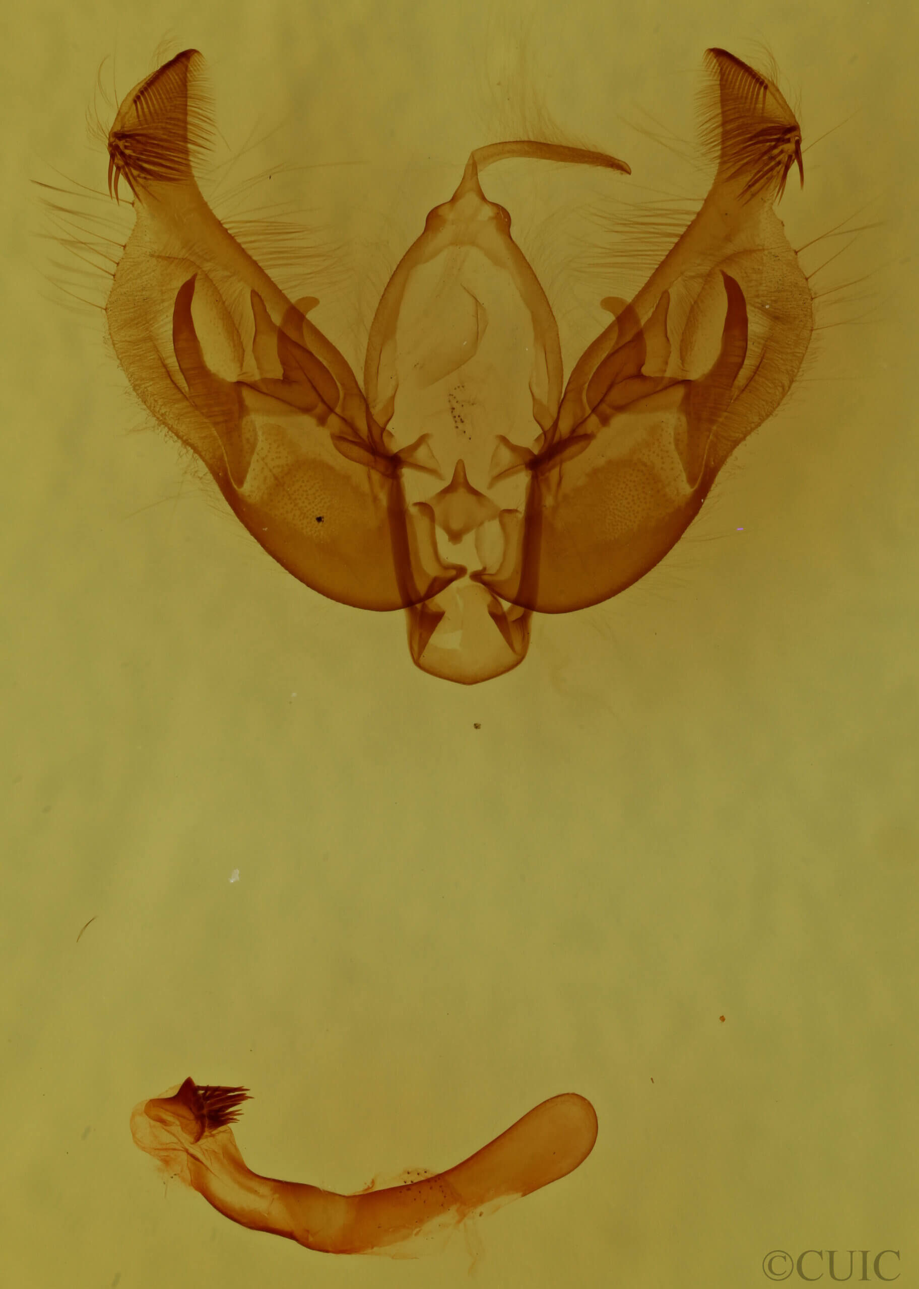 genitalia view of adult Diarsia sp.