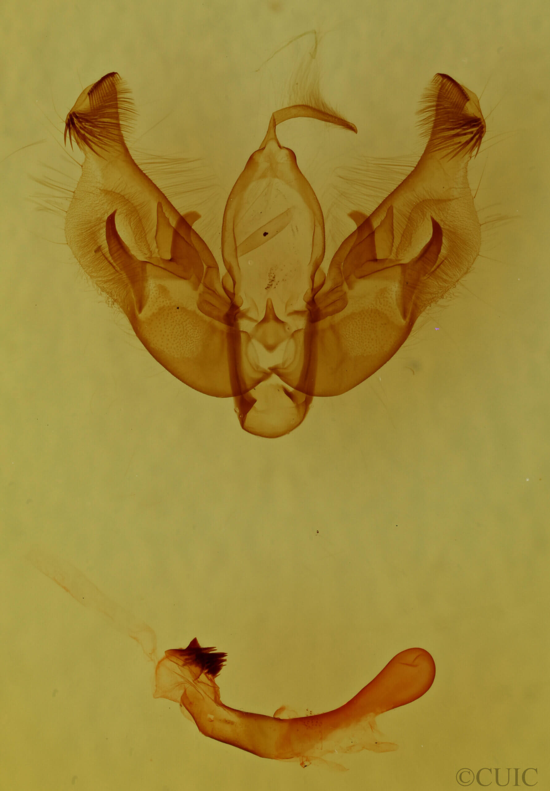 genitalia view of adult Diarsia sp.