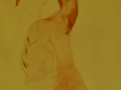 genitalia view of adult Nola sp.