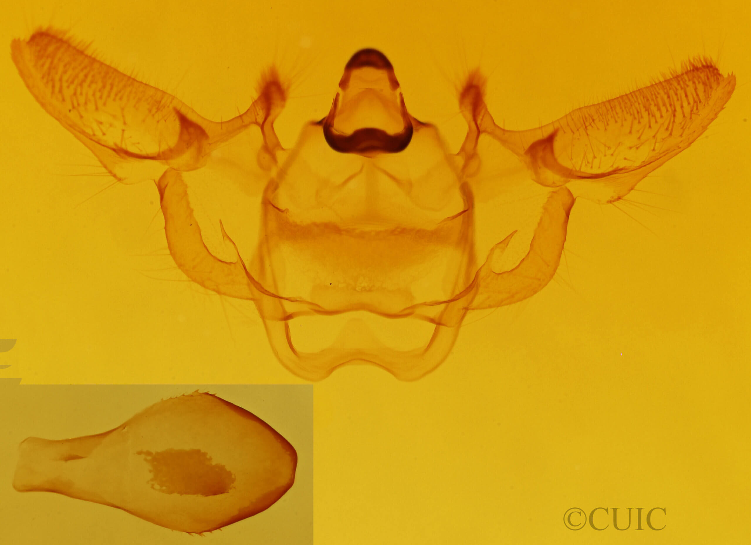 genitalia view of adult Xanthotype sospeta?