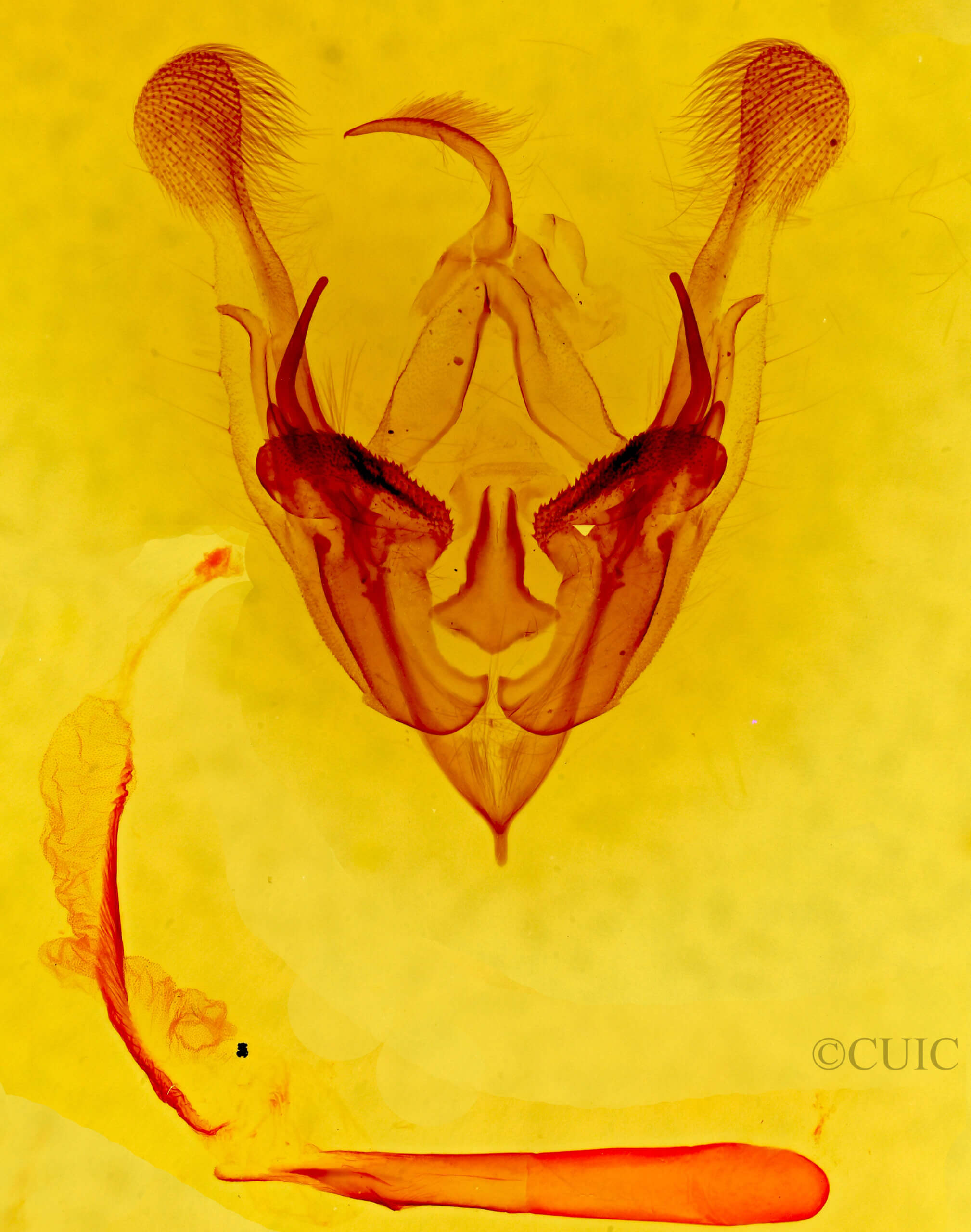 genitalia view of adult Protorthodes sp.