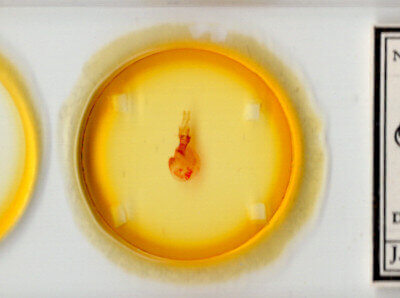 slide view of adult Orthodes sp.