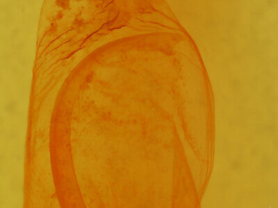 genitalia view of adult Orthodes sp.