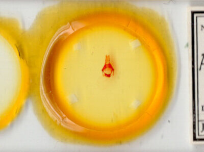 slide view of adult Pseudorthodes sp.