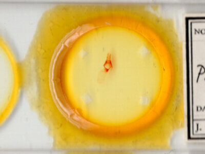 slide view of adult Pseudorthodes sp.