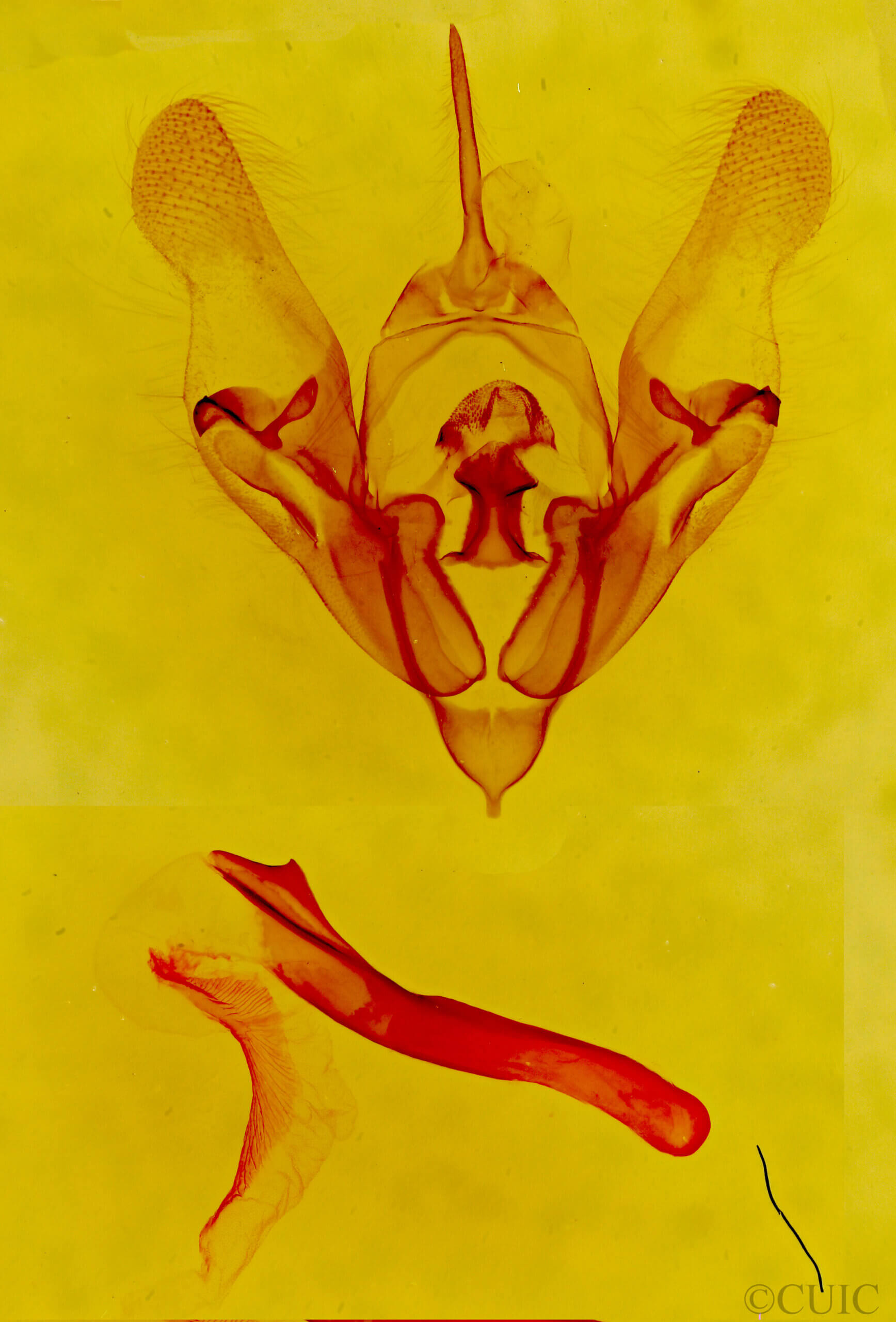 genitalia view of adult Protorthodes sp.