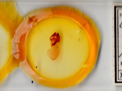 slide view of adult Charadra sp.