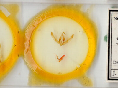 slide view of adult Stibaera sp.