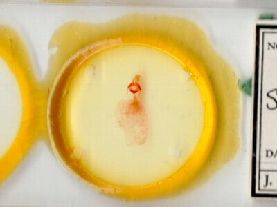 slide view of adult Stibaera sp.