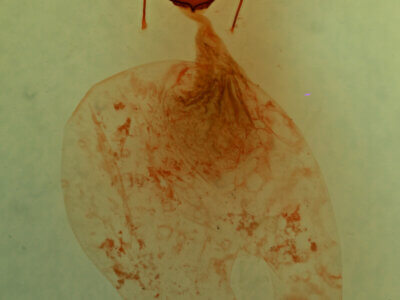 genitalia view of adult Stibaera sp.