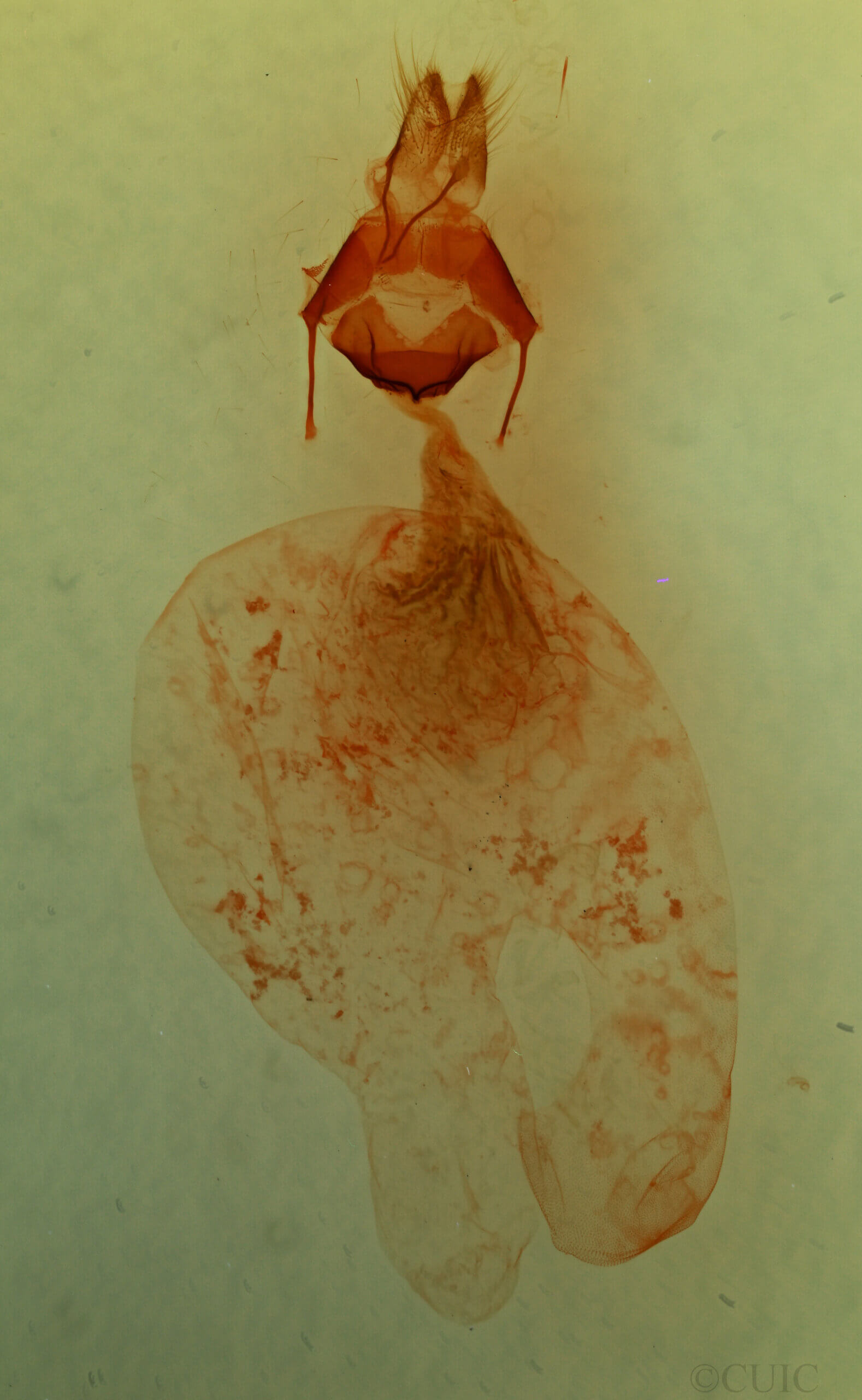 genitalia view of adult Stibaera sp.