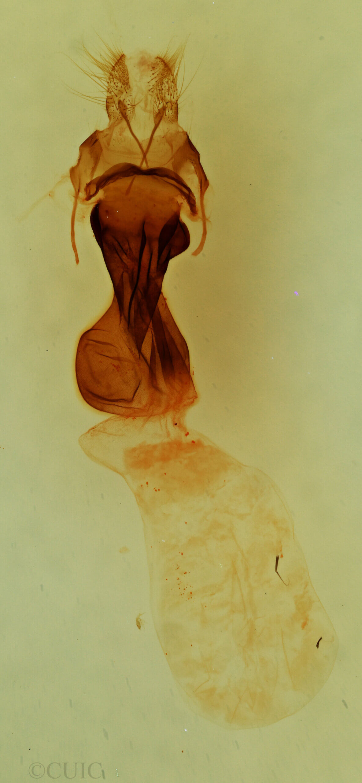 genitalia view of adult Elaphria sp.