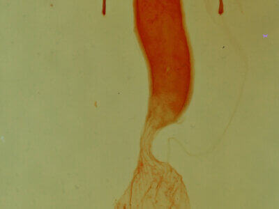 genitalia view of adult Elaphria sp.