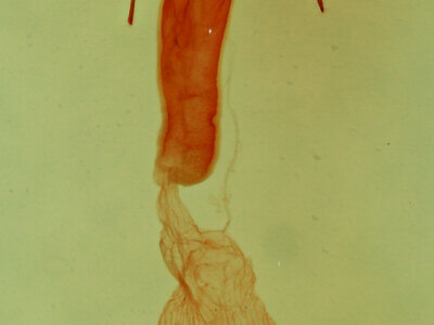 genitalia view of adult Elaphria sp.