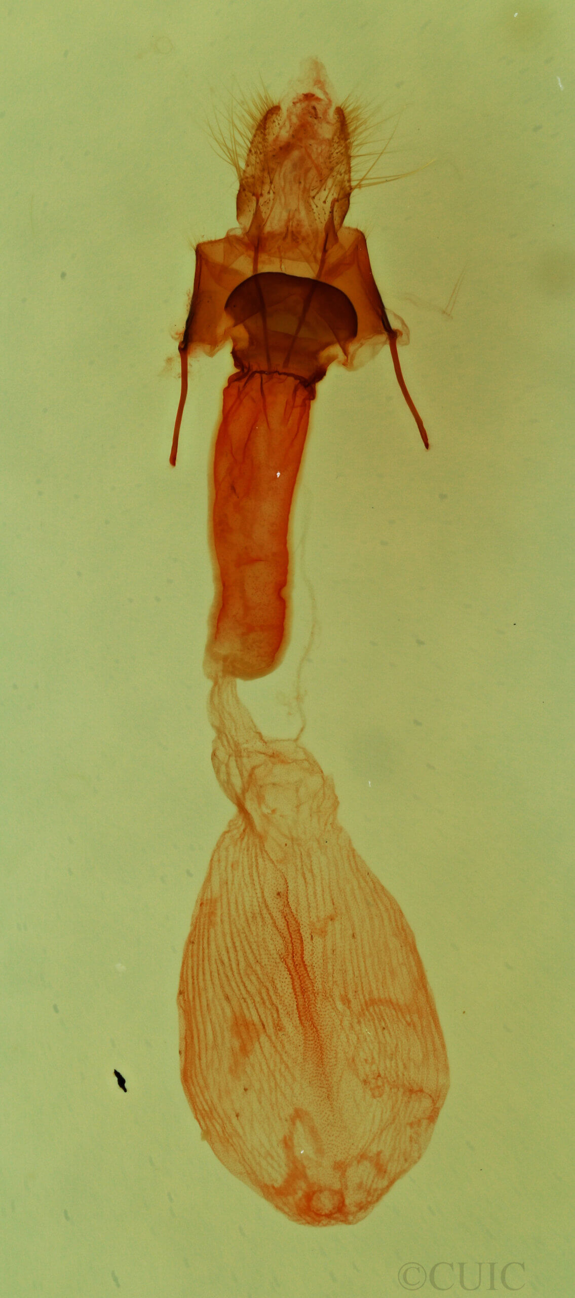 genitalia view of adult Elaphria sp.