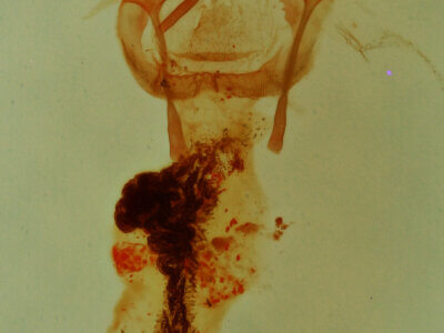 genitalia view of adult Emarginea sp.