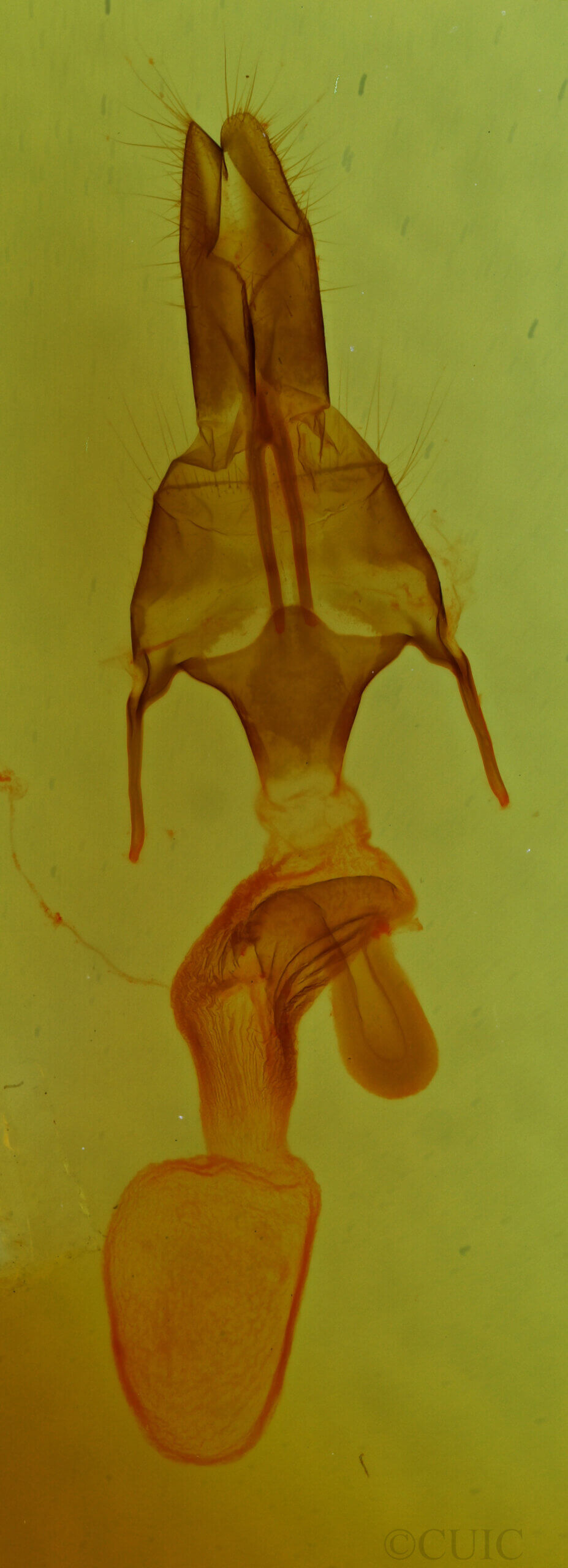 genitalia view of adult Mythimna sp.
