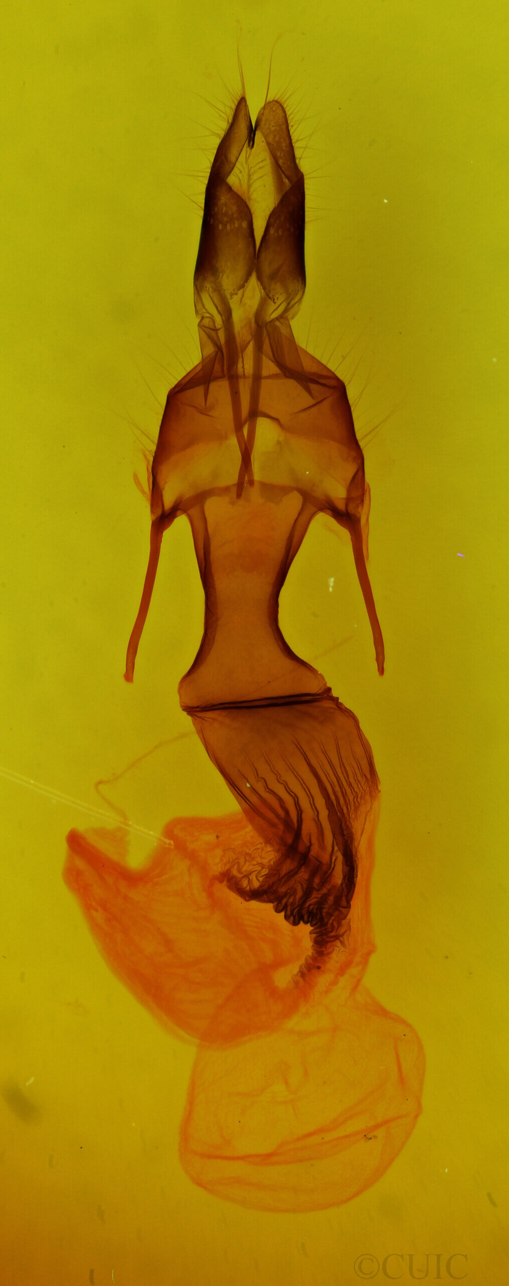 genitalia view of adult Mythimna sp.