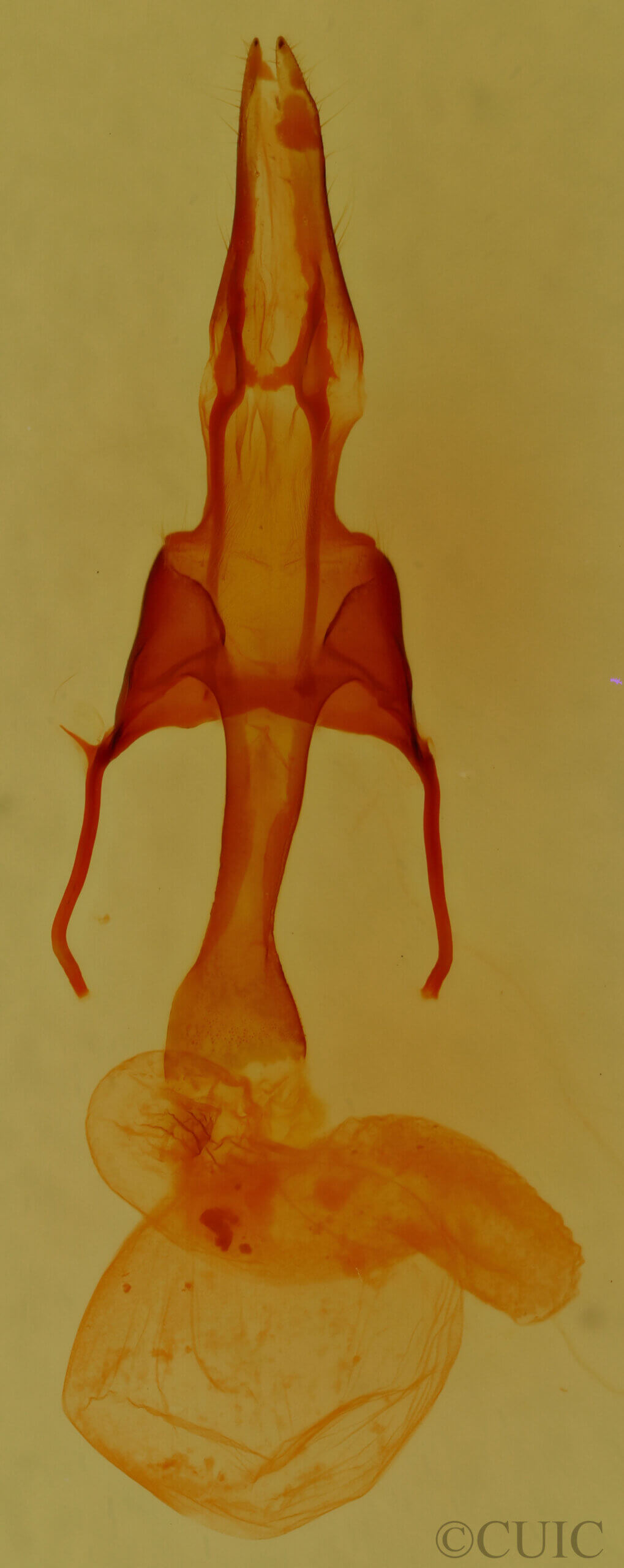 genitalia view of adult Tricholita chipeta?