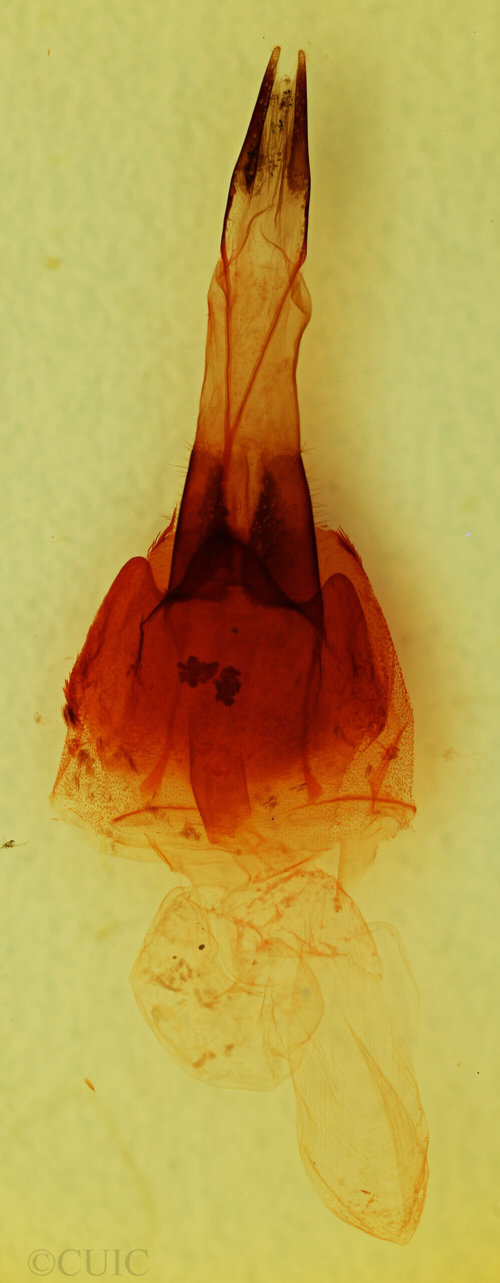 genitalia view of adult Protorthodes sp.