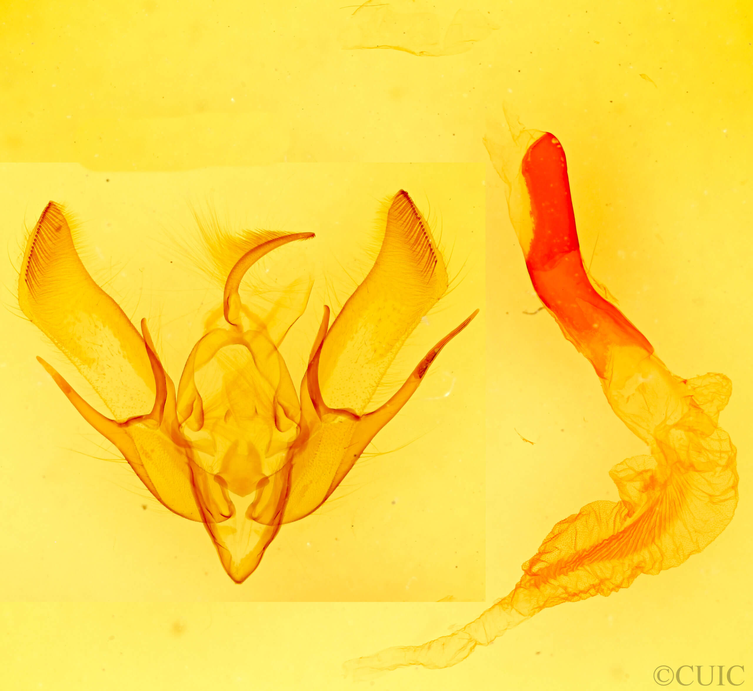 genitalia view of adult Euxoa tessellata