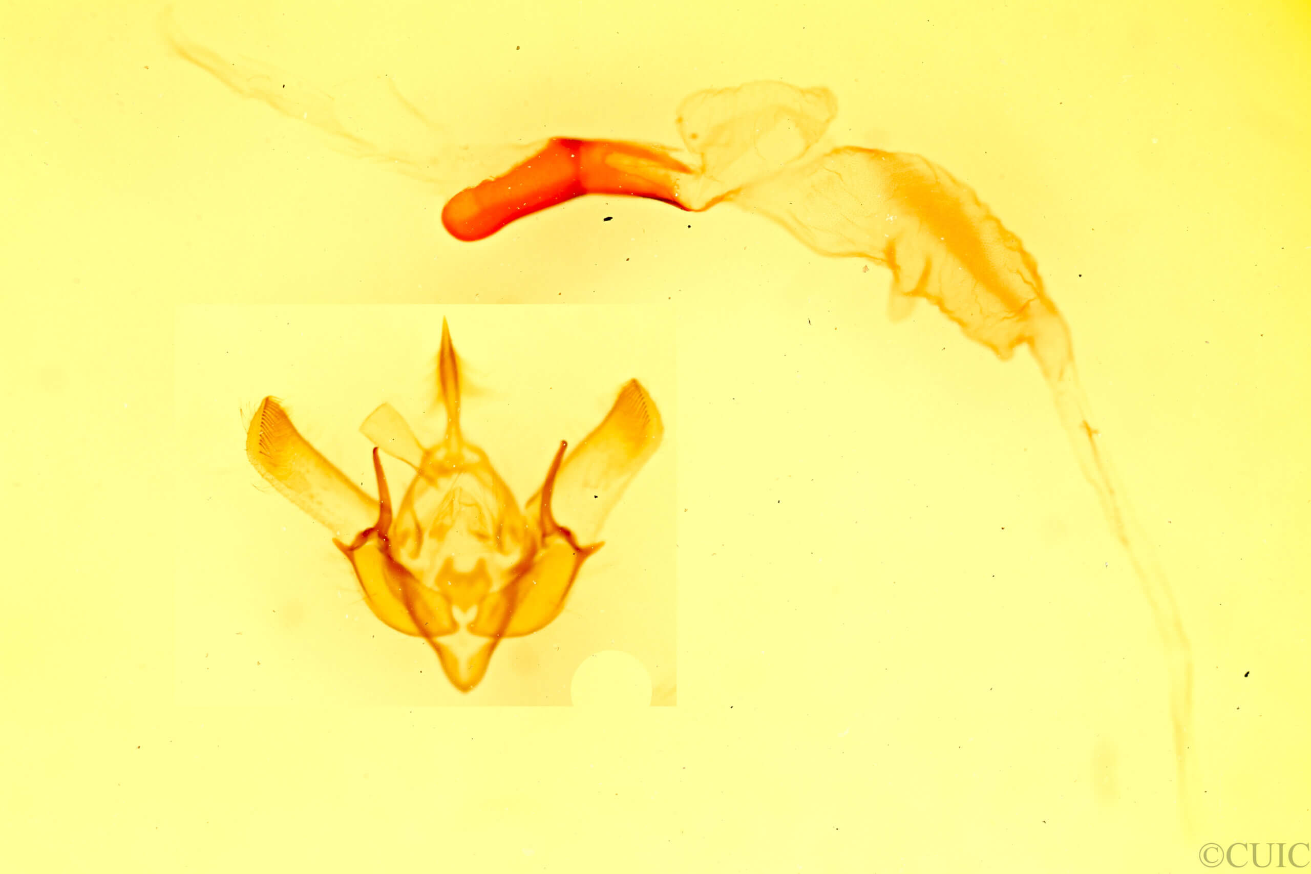 genitalia view of adult Euxoa tessellata