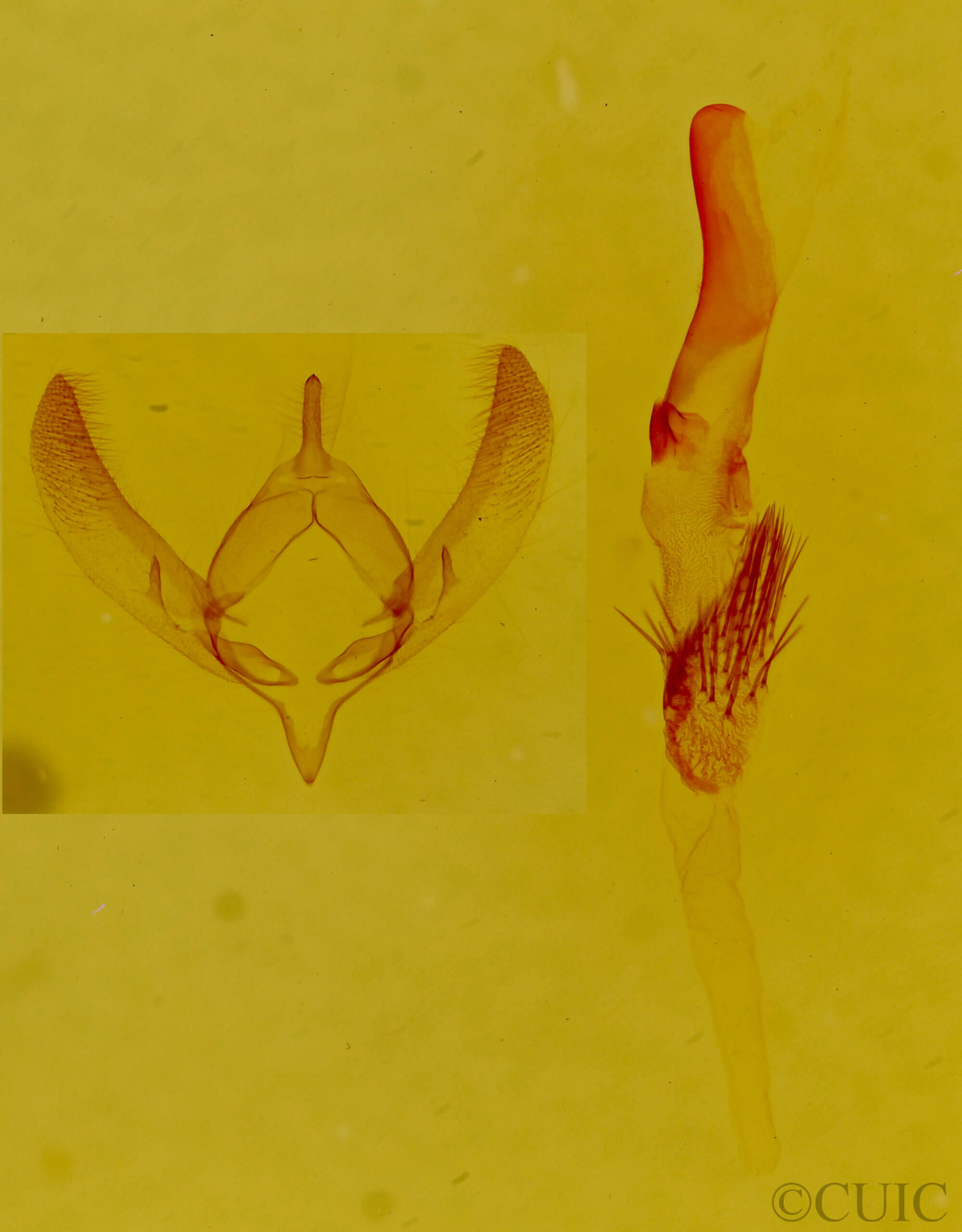 genitalia view of adult Redingtonia alba
