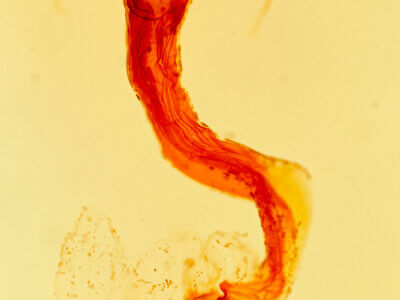 genitalia view of adult Labninatis n. gen. ditissima