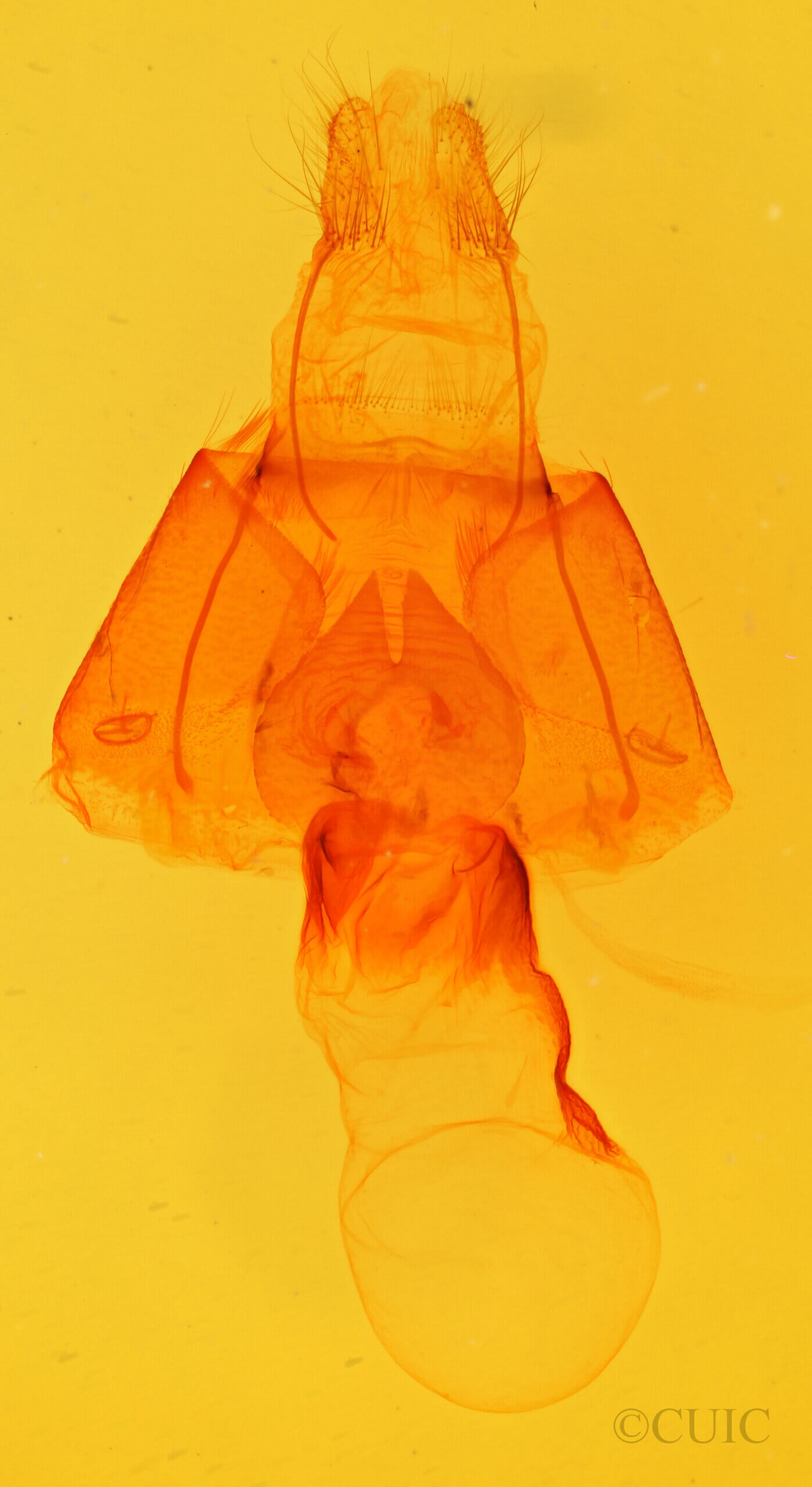 genitalia view of adult Zale peruncta