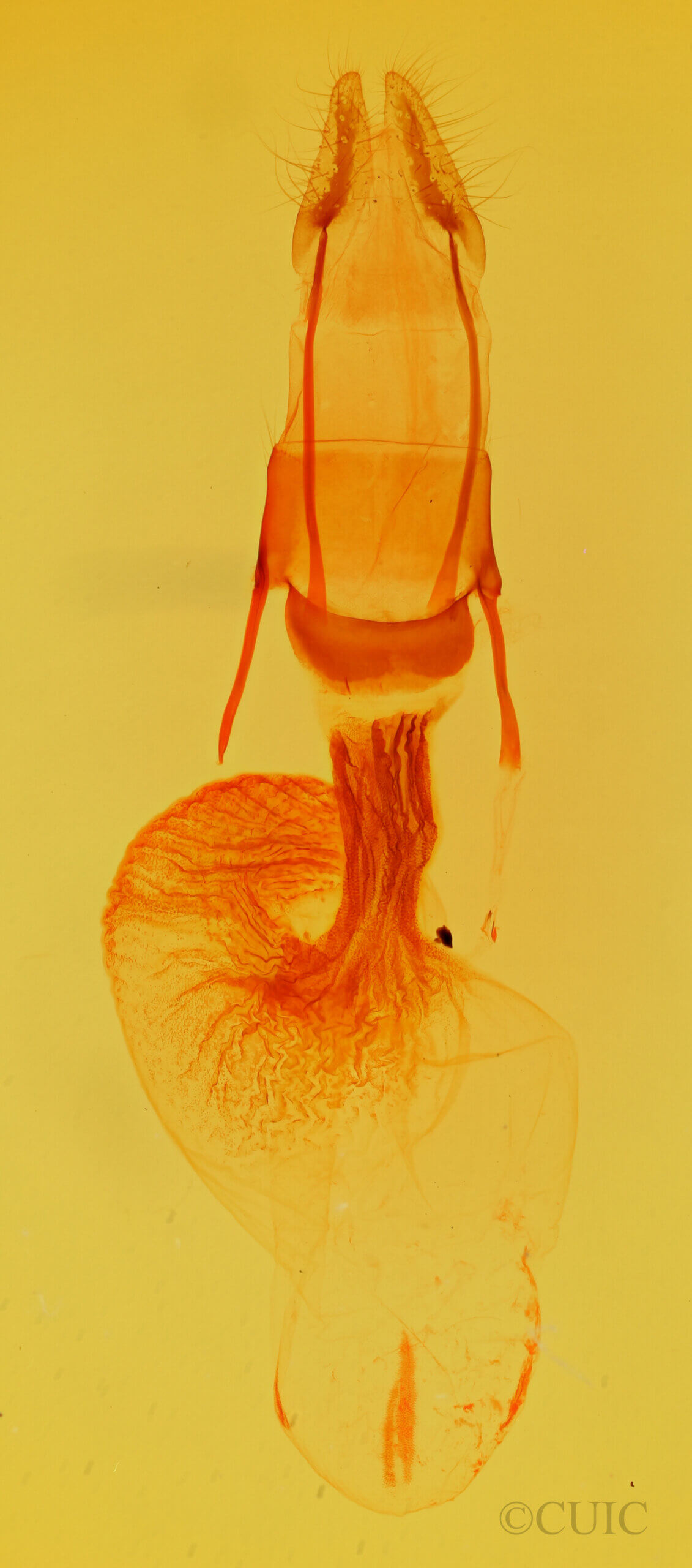 genitalia view of adult Oligia bridghami