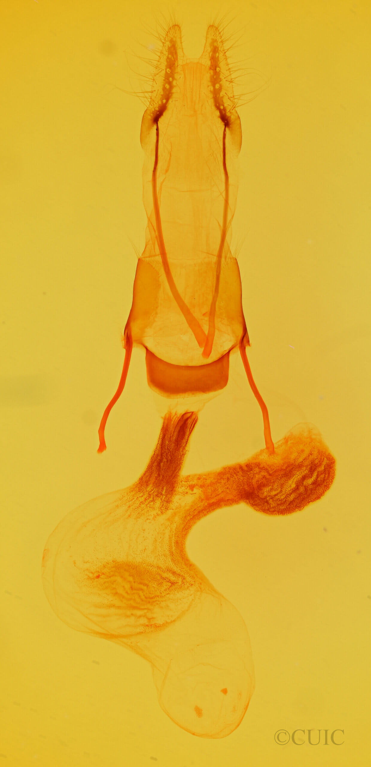 genitalia view of adult Oligia violacea